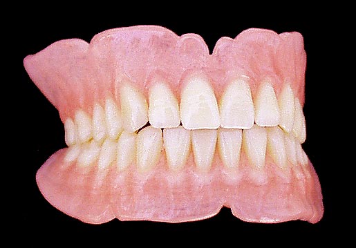 denture repairs